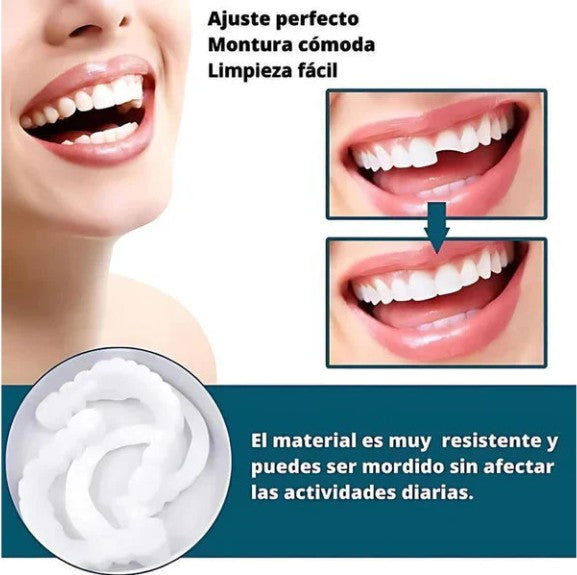 CARILLAS DENTALES Snap-On Smile