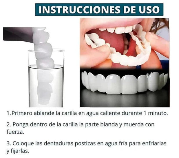 CARILLAS DENTALES Snap-On Smile