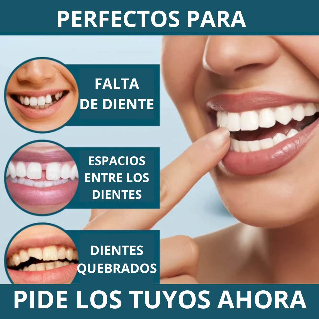 CARILLAS DENTALES Snap-On Smile