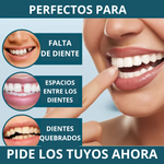 CARILLAS DENTALES Snap-On Smile