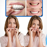 CARILLAS DENTALES Snap-On Smile