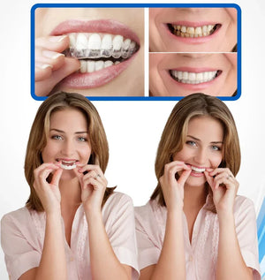 CARILLAS DENTALES Snap-On Smile